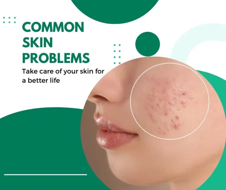 Most Common Skin Problems