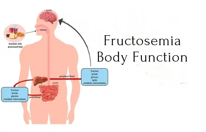 Fructosemia Causes