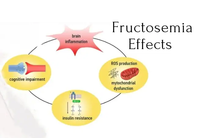 Fructosemia Effects Treatment